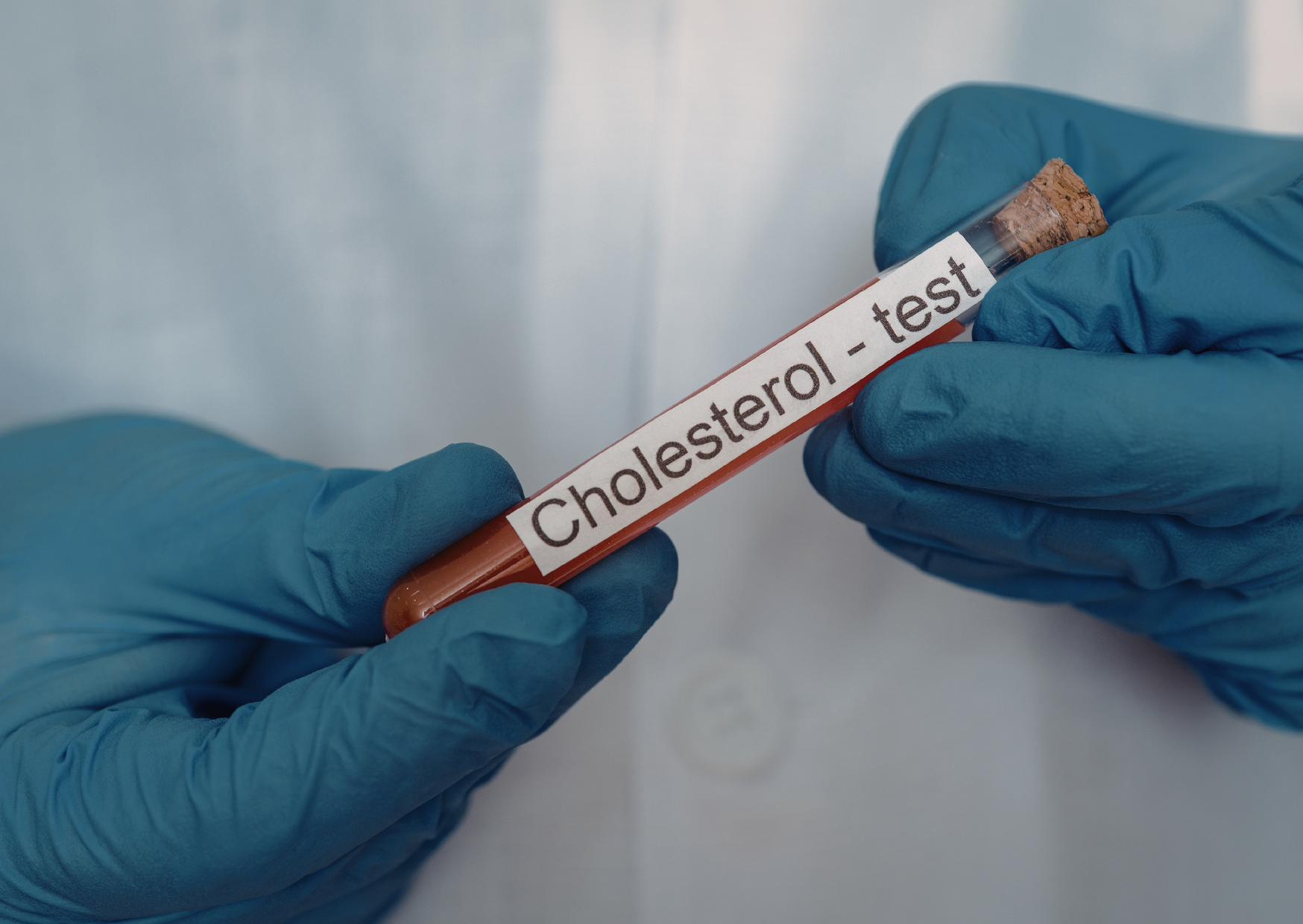 I Stopped Eating Like an American for 6 Months And I Ate Like a European for 6 Months: My Cholesterol Didn’t Behave Like I Expected 6 cholesterol pill 2